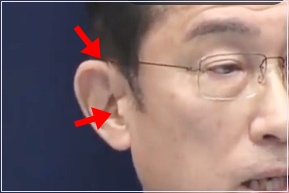 岸田総理 耳 切れ目